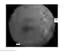 Fig. 01 - AUTOMATED BLOOD VESSEL FEATURE DETECTION AND QUANTIFICATION FOR RETINAL IMAGE GRADING AND DISEASE SCREENING