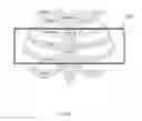 Fig. 04 - System for simulation for the development and optimization of person specific surgical methods and materials: thorax simulation apparatus, system and process