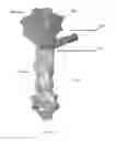 Fig. 16 - System for simulation for the development and optimization of person specific surgical methods and materials: thorax simulation apparatus, system and process