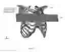 Fig. 22 - System for simulation for the development and optimization of person specific surgical methods and materials: thorax simulation apparatus, system and process