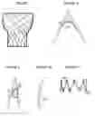 Fig. 06 - Aortic valve stent graft