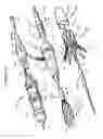 Fig. 09 - Aortic valve stent graft