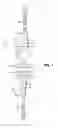 Fig. 02 - TAPERED FIXATION DEVICE FOR A KNEE REPLACEMENT