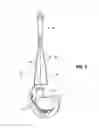 Fig. 04 - TAPERED FIXATION DEVICE FOR A KNEE REPLACEMENT
