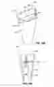 Fig. 09 - TAPERED FIXATION DEVICE FOR A KNEE REPLACEMENT
