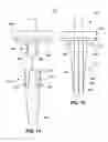 Fig. 10 - TAPERED FIXATION DEVICE FOR A KNEE REPLACEMENT