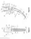 Fig. 02 - Arcuate fixation member