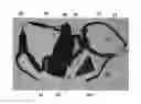 Fig. 01 - ROTATION AND ABDUCTION DEVICE FOR SHOULDER IMMOBILIZATION
