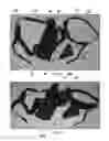 Fig. 02 - ROTATION AND ABDUCTION DEVICE FOR SHOULDER IMMOBILIZATION