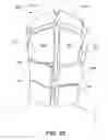Fig. 07 - Cerebral protection system