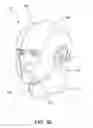 Fig. 09 - Cerebral protection system