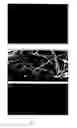 Fig. 02 - Nanobiocomposite formulation for wound healing and a process for the preparation thereof