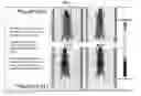 Fig. 02 - Trifunctional constructs with tunable pharmacokinetics useful in imaging and anti-tumor therapies