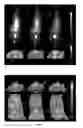 Fig. 02 - QUANTITATIVE PET IMAGING OF TISSUE FACTOR EXPRESSION USING 18F-LABLED ACTIVE SITE INHIBITED FACTOR VII