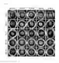 Fig. 07 - Adhesion prevention agent comprising injectable thermosensitive wood based-oxidized cellulose nanofiber