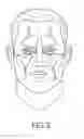 Fig. 03 - Kit for treatment of sinusitis