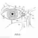 Fig. 04 - Kit for treatment of sinusitis