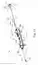 Fig. 02 - Adjustable instrument for dilation of anatomical passageway