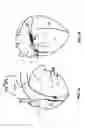 Fig. 02 - Methods and devices for multi-stage ventricular therapy