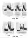 Fig. 07 - NEUROMODULATION APPARATUS