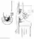 Fig. 02 - Radiosurgery of cancers in the breast and the head using a single multi-source gamma-ray device