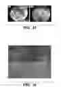 Fig. 35 - Compositions and methods for epithelial stem cell expansion and culture