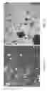 Fig. 08 - Processes for separating whole stillage to produce a fiber rich product that includes C5 and C6 polysaccharides