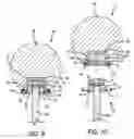 Fig. 08 - Treatment element attachment system