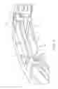 Fig. 03 - Hydrostatic non-contact seal with offset outer ring