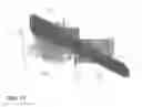 Fig. 16 - DIRECT SPECIMEN COLLECTION DEVICE AND CASSETTE