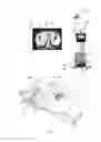 Fig. 02 - System and method for the determination of a dose in radiotherapy
