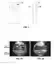 Fig. 02 - Stabilization and rolling shutter correction for omnidirectional image content