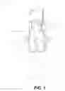 Fig. 02 - Flocked shapewear garments