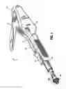 Fig. 02 - Anastomotic staple with capillary which expels a bonding agent upon deformation