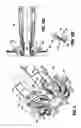 Fig. 07 - Anastomotic staple with capillary which expels a bonding agent upon deformation