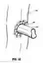 Fig. 09 - Anastomotic staple with capillary which expels a bonding agent upon deformation