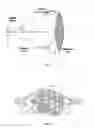 Fig. 02 - Device and system for restricting fluid flow in physiological vessels