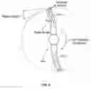 Fig. 09 - TISSUE DISPLACEMENT TOOLS AND METHODS