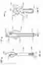 Fig. 45 - TISSUE DISPLACEMENT TOOLS AND METHODS