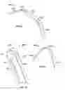Fig. 49 - TISSUE DISPLACEMENT TOOLS AND METHODS