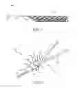 Fig. 02 - Connection of a manipulation member to an endovascular intervention device