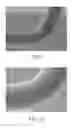 Fig. 07 - Connection of a manipulation member to an endovascular intervention device