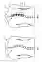 Fig. 02 - Vertebral tethering