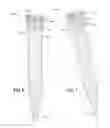 Fig. 06 - Magnetic core bone screw