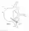 Fig. 07 - Magnetic core bone screw