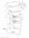 Fig. 08 - Magnetic core bone screw