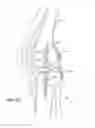 Fig. 09 - Magnetic core bone screw