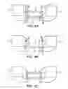 Fig. 06 - Cortical loop fixation system for ligament and bone reconstruction