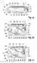 Fig. 02 - CONTINUOUSLY ADJUSTABLE INTERVERTEBRAL IMPLANT