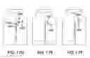 Fig. 49 - DEVICES AND METHODS FOR GASTROINTESTINAL BYPASS